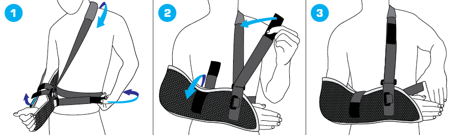 How To Apply - 997 Arm Sling